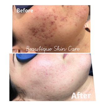 Beautique Skin Care and Body Studio In Linden NJ | Vagaro